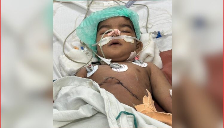 rare liver transplant