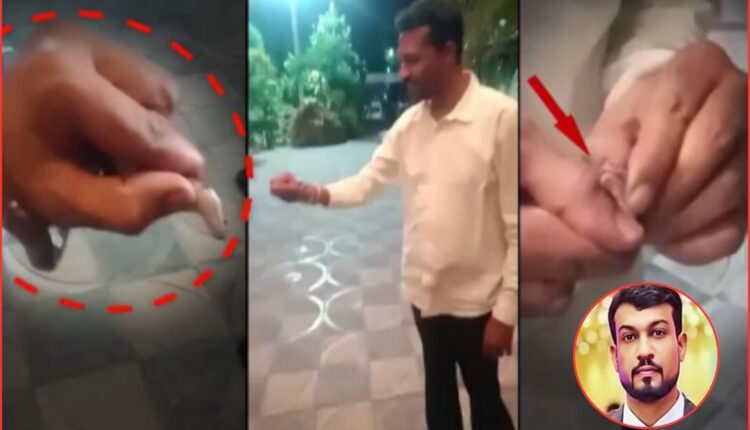 Hyderabad businessman snake bite